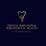 DENTAL IMPLANTS And PERIODONTAL HEALTH Profile Picture